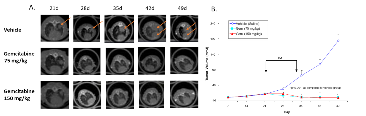 Figure 4: Effect of gemcitabine against human non-small cell lung adenocarcinoma H441 implanted OT into nude mice. A. Representative longitudinal images. B. Quantification of tumor volume.